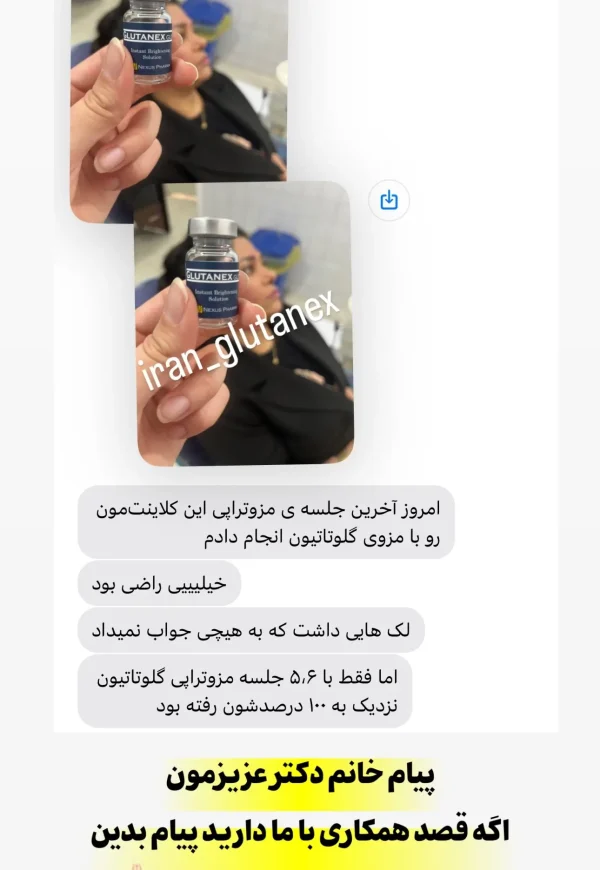 پیام رضایت یکی از پزشکان برای درمان یکی از مشتریان به وسیله ویال های مزوتراپی گلوتانکس